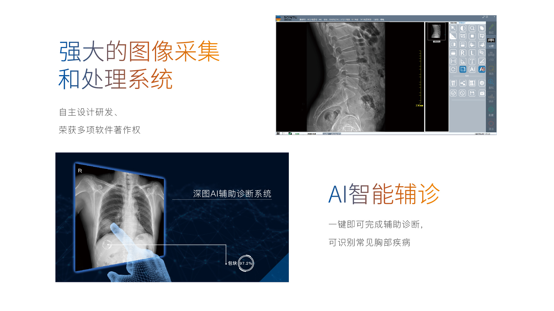200系列悬吊单板DR